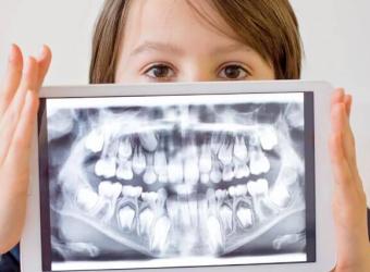 Dental X-Rays: 7 of Your Top Questions, Answered!