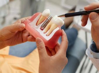 Dentures vs. Implants: Exploring Options for Full Arch Restoration